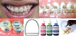 Orthodontic