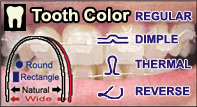 Tooth Color Esthetic Arches