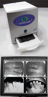 Digital X-Ray Film Reader (USB)