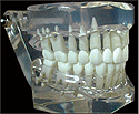Ideal Occlusion and Orthodontic Malocclusion Models