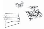 Retainer Plastic